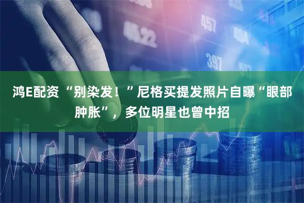 鸿E配资 “别染发！”尼格买提发照片自曝“眼部肿胀”，多位明星也曾中招